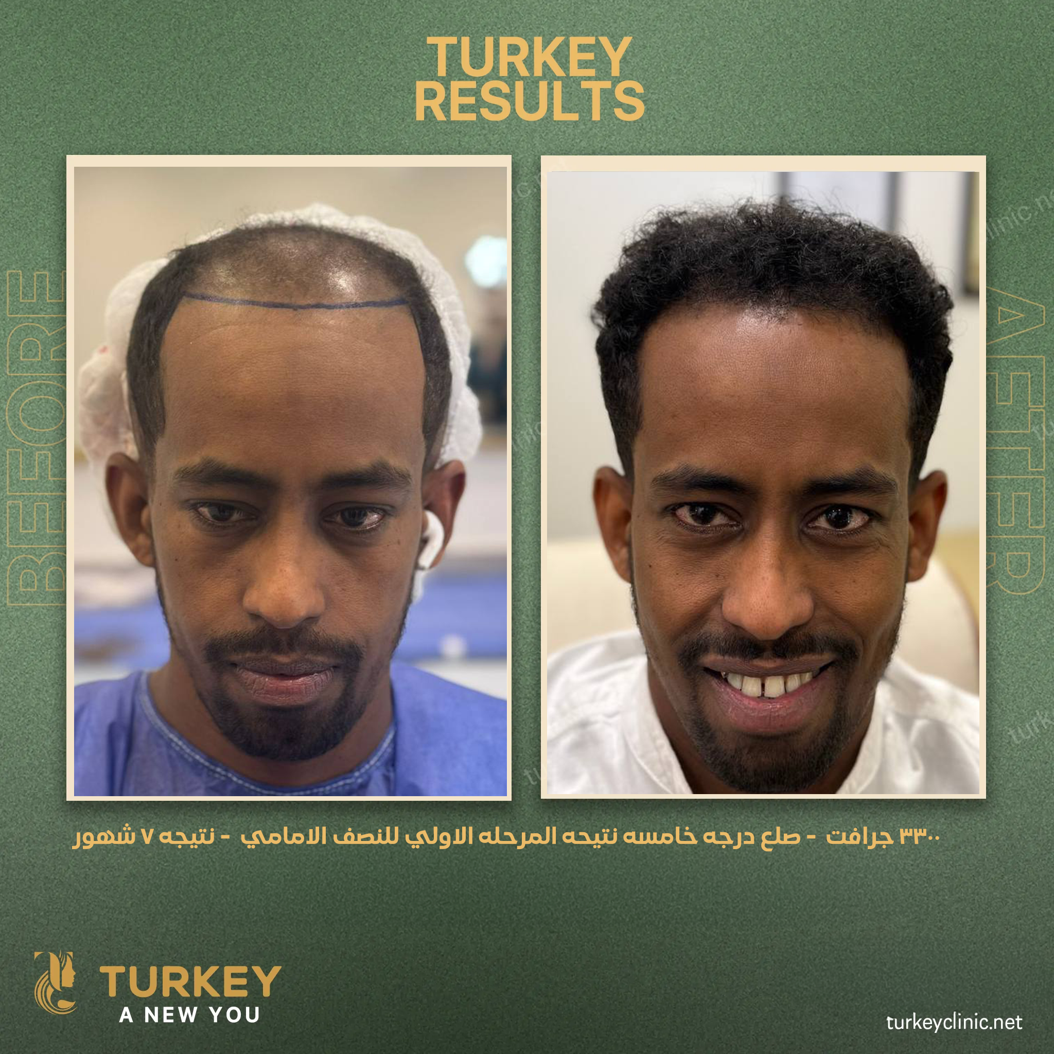 3300 جرافت صلع درجة خامسة نتيجة المرحلة الاولي للنصف الامامي نتجية 7 شهور