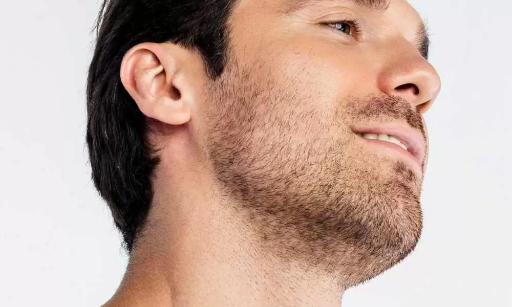 زراعة الشعر بالاقتطاف