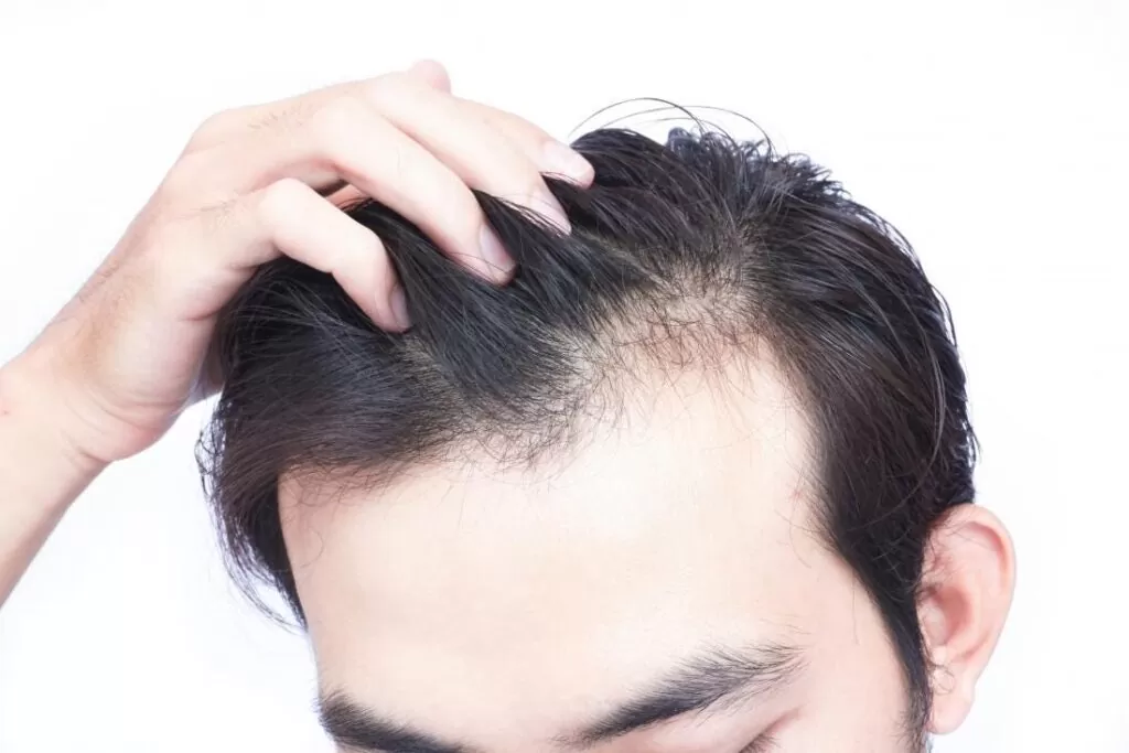 مميزات زراعة الشعر بتقنية DHI
