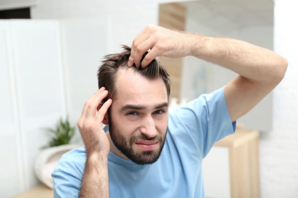 علاج الصلع عند الرجال