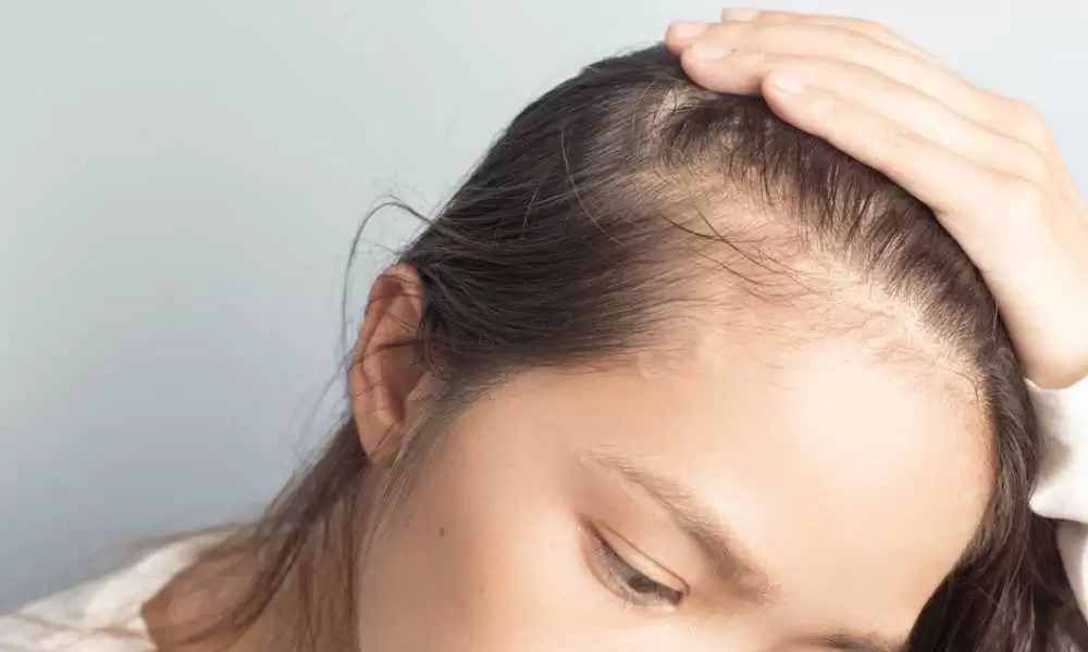 طرق تصغير الجبهة وأهم التعليمات حول النصائح بعد العملية 5 زراعة الشعر الطبيعي بالاقتطاف FUE