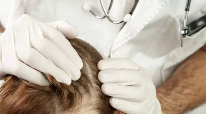 سبب تساقط الشعر