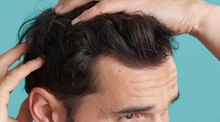 علاج تساقط الشعر للرجال