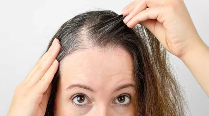علاجات تساقط الشعر عند النساء