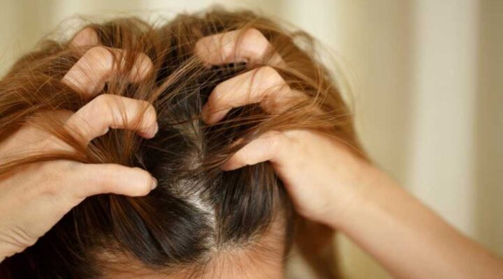 كيفية زراعة الشعر للنساء
