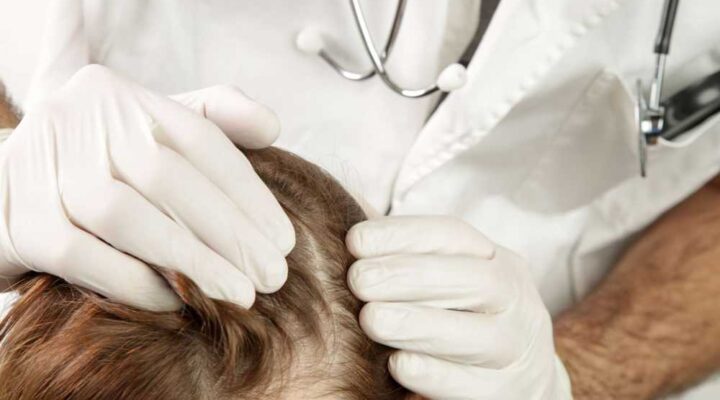 كم تستغرق عملية زرع الشعر