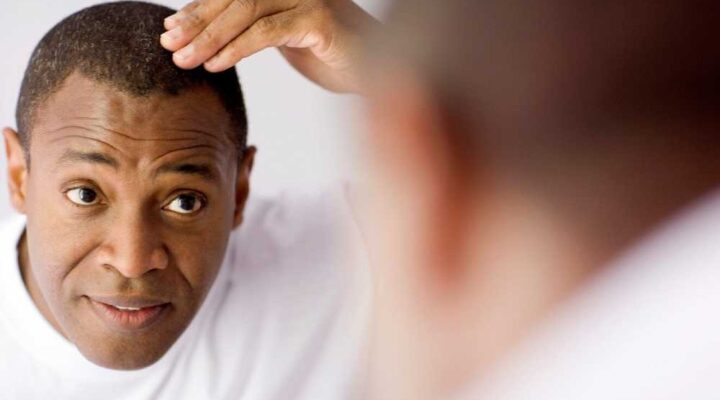معلومات عن زراعة الشعر