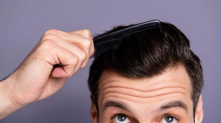 زراعة الشعر بدون حلاقة