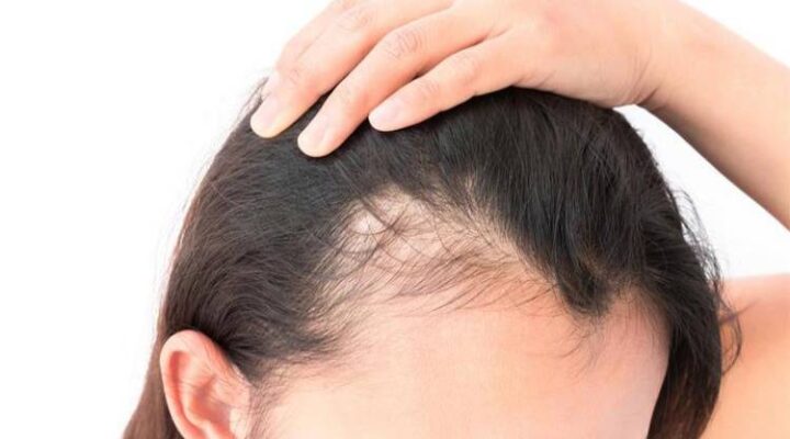 علاج الشعر المتساقط عند البنات