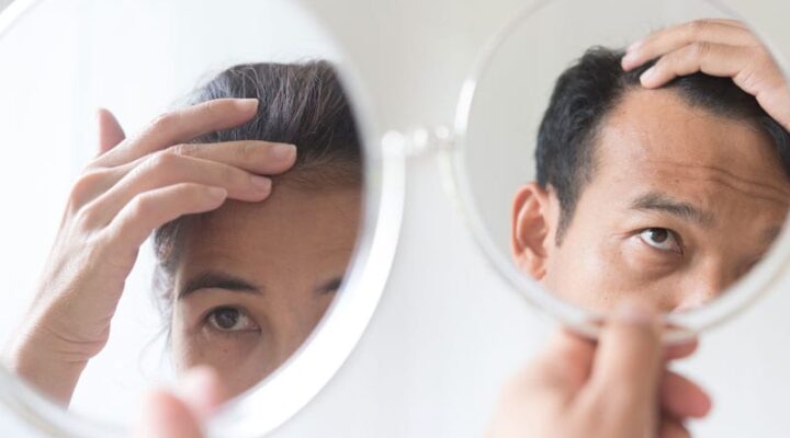 كيف تتم عملية زراعة الشعر
