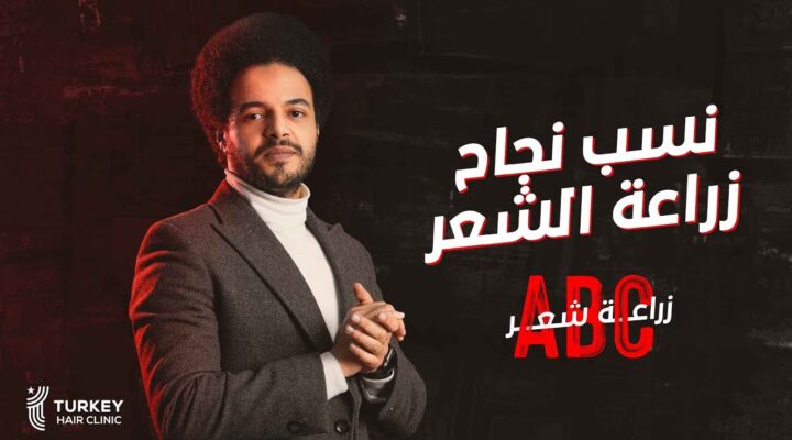 نسبة نجاح زراعة الشعر