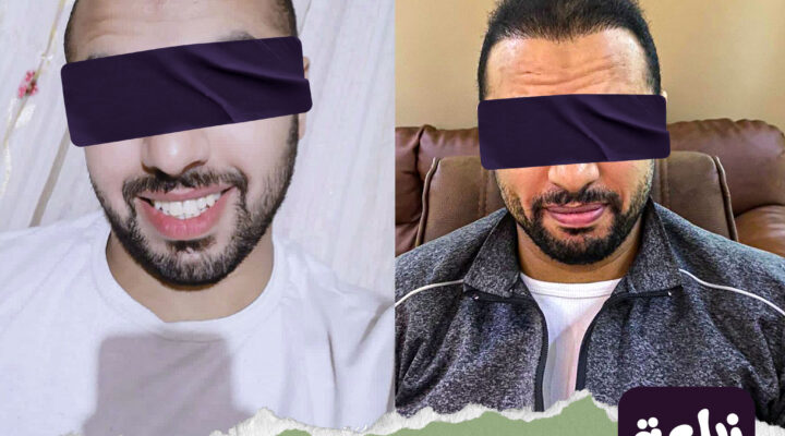 Before and after 19