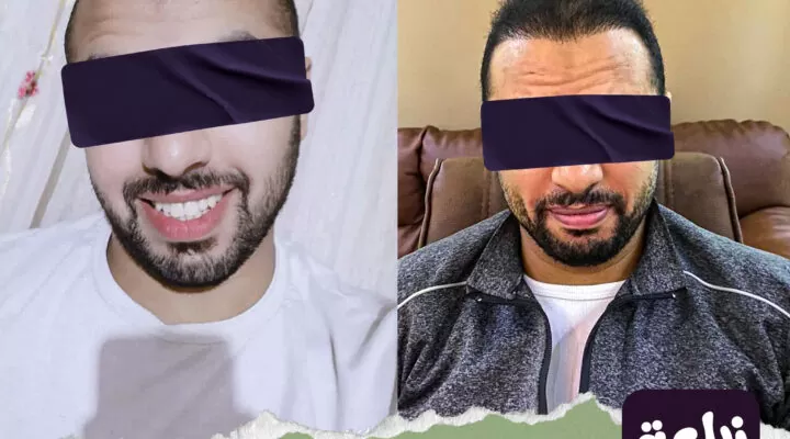 Before and after 19