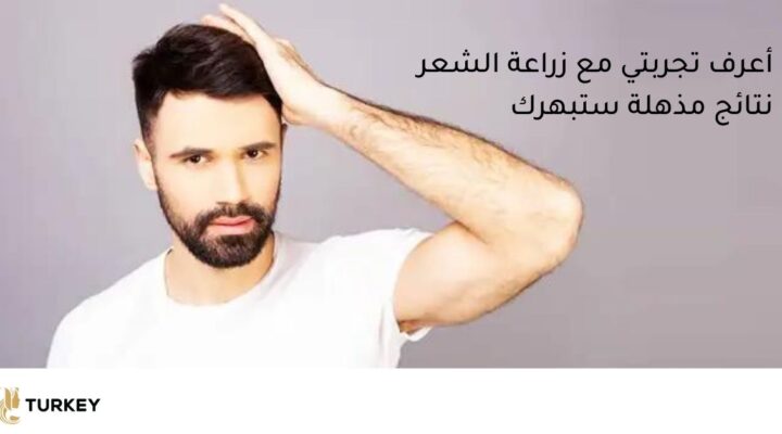 تجارب عمليات زرع الشعر بالصور