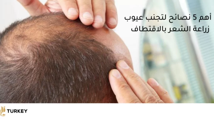 أهم 5 نصائح لتجنب عيوب زرع الشعر بتقنية بالاقتطاف