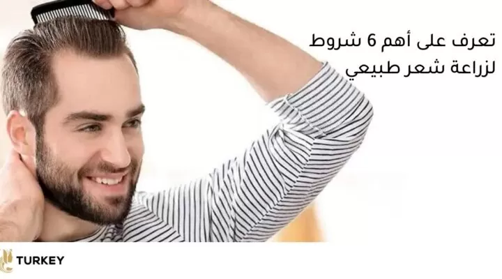 تعرف على أهم 6 شروط زرع شعر طبيعي