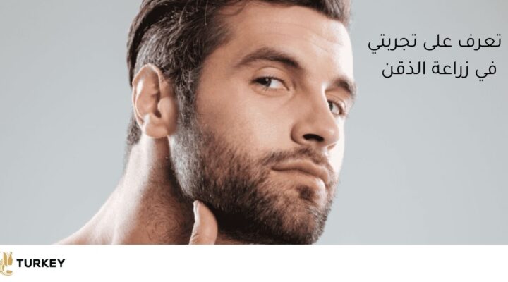 تعرف على تجربتي في زرع اللحية