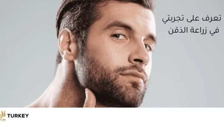 تعرف على تجربتي في زرع اللحية