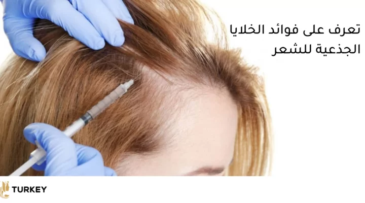 هل تنجح زراعة الشعر بالخلايا الجذعية فعلًا؟ الحقيقة الكاملة 11 زراعة الشعر بالخلايا الجذعية