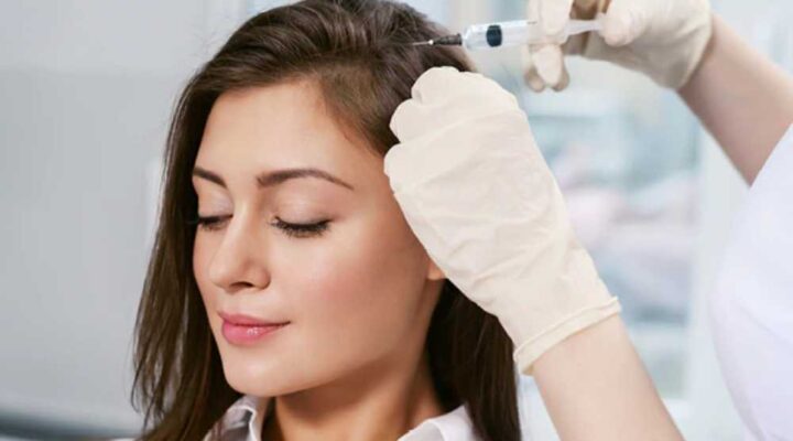 حقن ميزوثيرابي للشعر