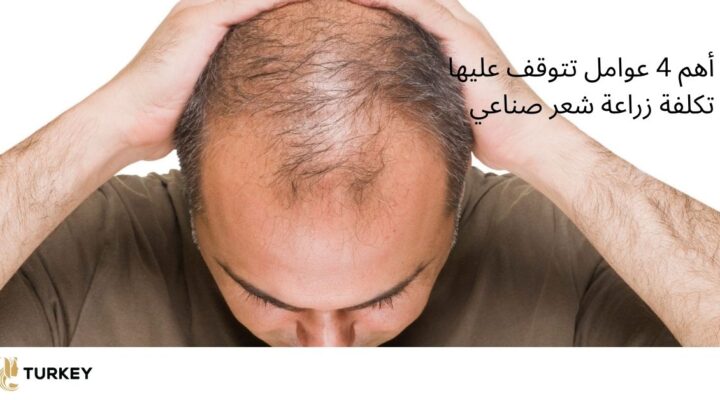 زراعة الشعر الصناعي بالبيوفايبر