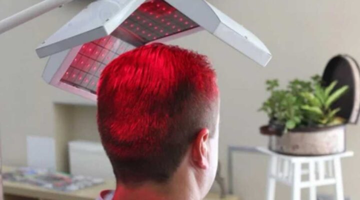 زراعة الشعر بالليزر