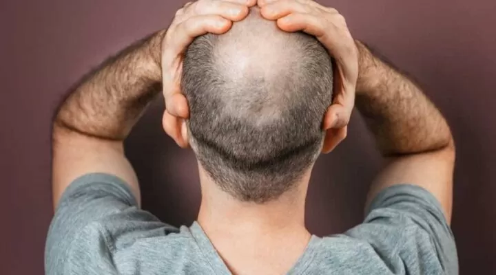 علاج تساقط الشعر للرجال وتكثيفه