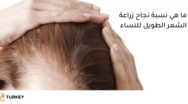 ما هو مدى نجاح عمليات زراعة الشعر الطويل عند النساء