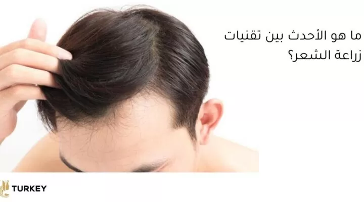 أفضل طرق زراعة الشعر