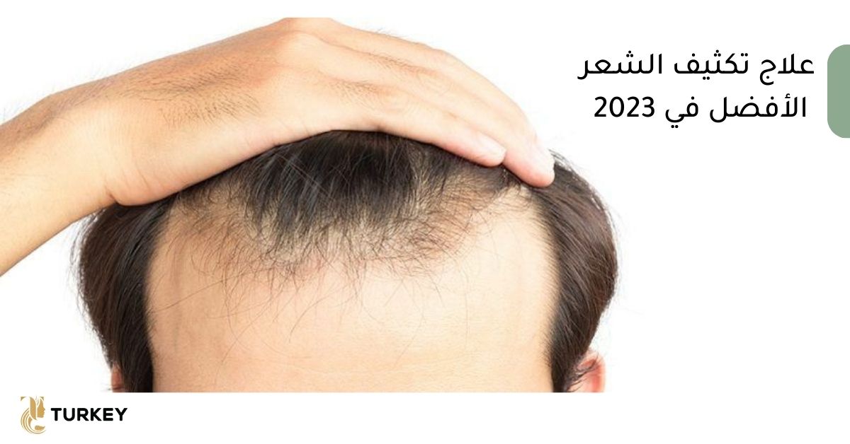 علاج تكثيف الشعر الأفضل في 2023