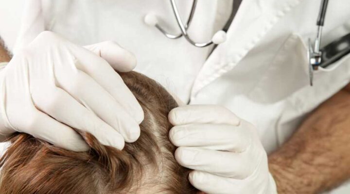 الوقت المناسب لزراعة الشعر