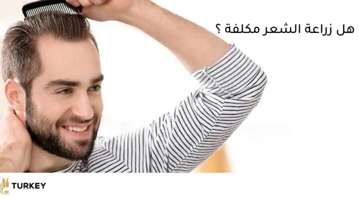 هل زراعة الشعر مكلفة