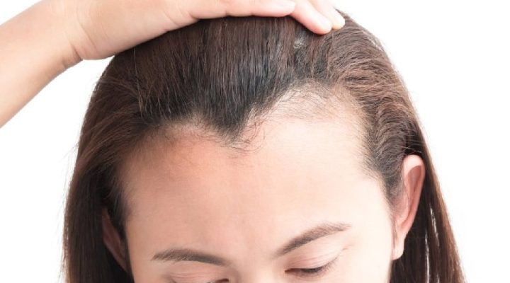 ثمن زراعة الشعر الأفضل في مصر 2026