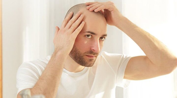 نتائج زراعة الشعر