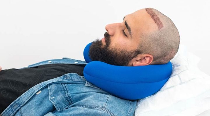 الممنوعات بعد زراعة الشعر