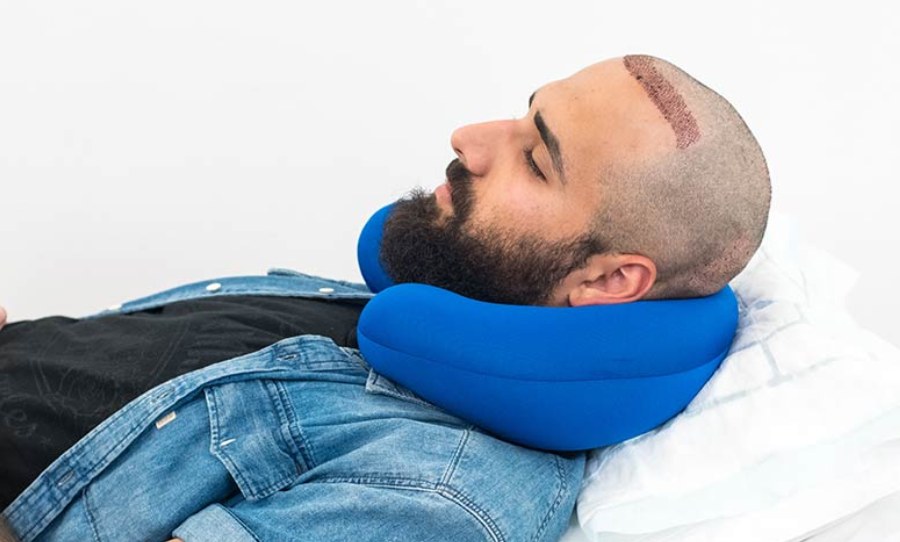 الممنوعات بعد زراعة الشعر