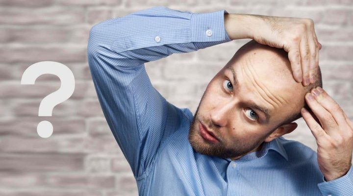 متى يزول البنج بعد زراعة الشعر