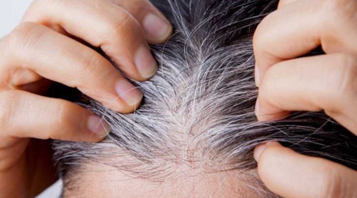 هل زراعة الشعر تعالج الشعر الأبيض