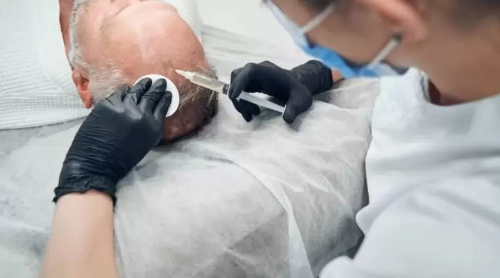 بديل زراعة الشعر