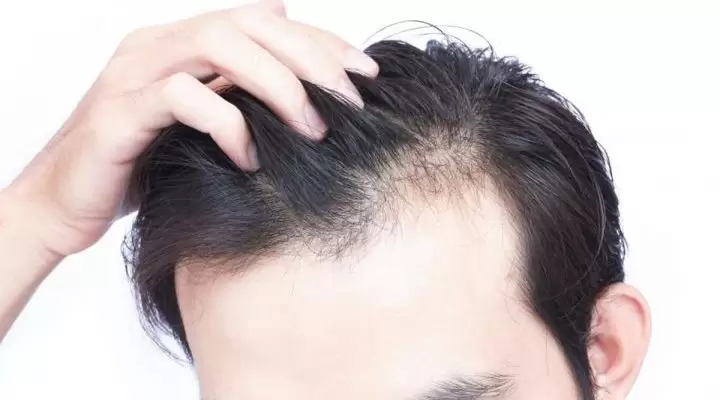 زراعة الشعر في تركيا