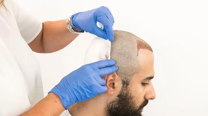 أفضل كريم بعد زراعة الشعر