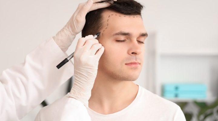 أفضل مركز لزراعة الشعر