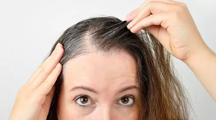 تجربتي في زراعة الشعر للنساء