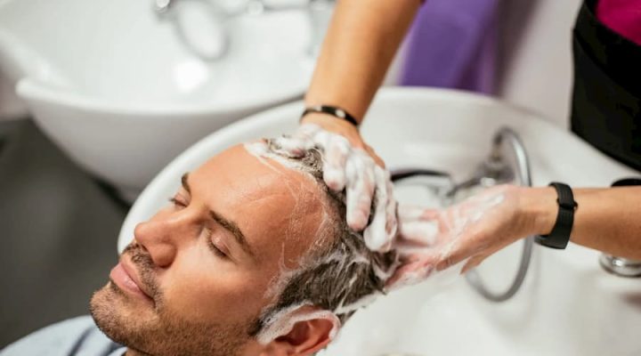 لوشن بعد زراعة الشعر