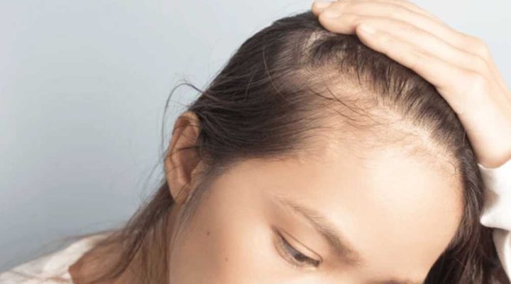 سعر زراعة الشعر في الجبهة