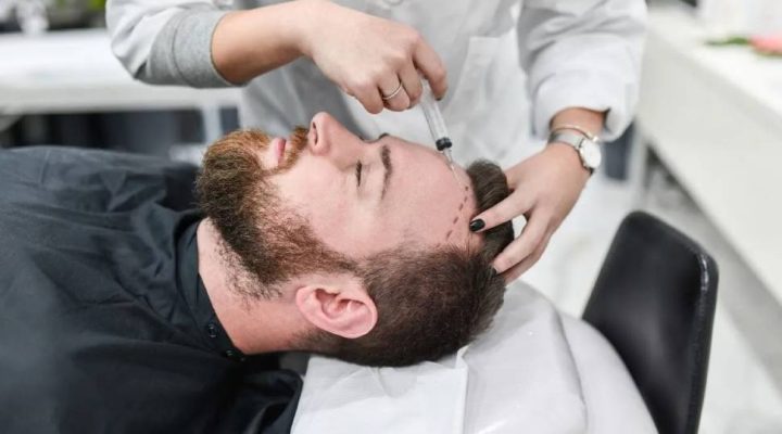 تخدير زراعة الشعر