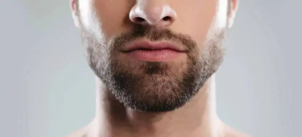 زراعة اللحية بعد شهر
