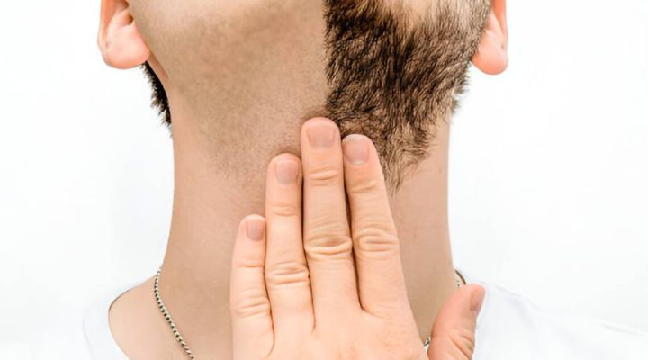 زراعة شعر لحية