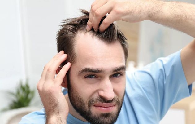 افضل عيادة زراعة شعر Best hair transplant clinic