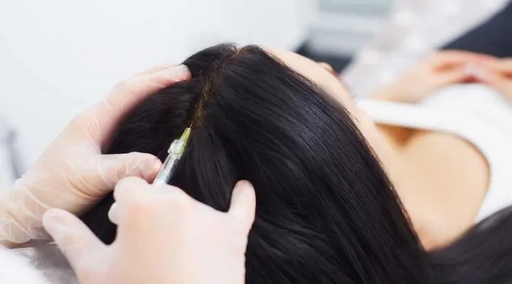 بدائل زراعة الشعر